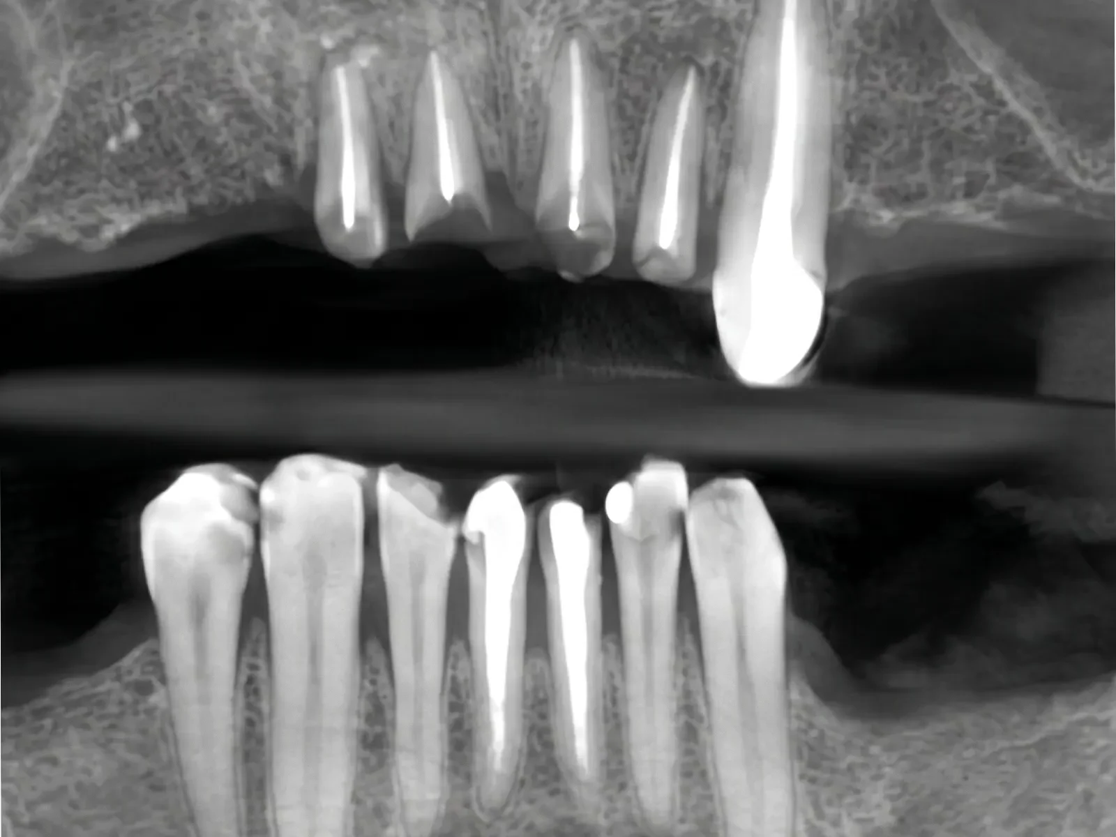 X-Ray