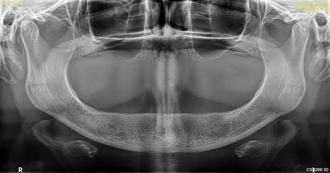 X-Ray